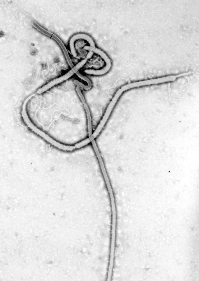 Ebola_virus_em.png